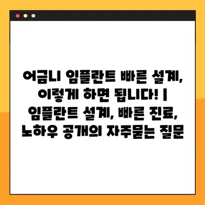 어금니 임플란트 빠른 설계, 이렇게 하면 됩니다! | 임플란트 설계, 빠른 진료, 노하우 공개